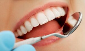 7 Lỗi sai thường gặp trong chăm sóc răng miệng có thể gây hại men răng