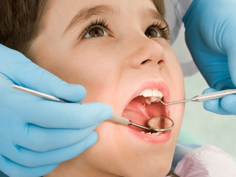 Bố mẹ cần làm gì để phòng ngừa sâu răng cho trẻ nhỏ? 5 Cách phòng sâu răng cho bé an toàn