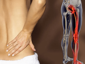 Đau lưng dưới gần mông ở nữ giới là bệnh gì? Có nguy hiểm không?